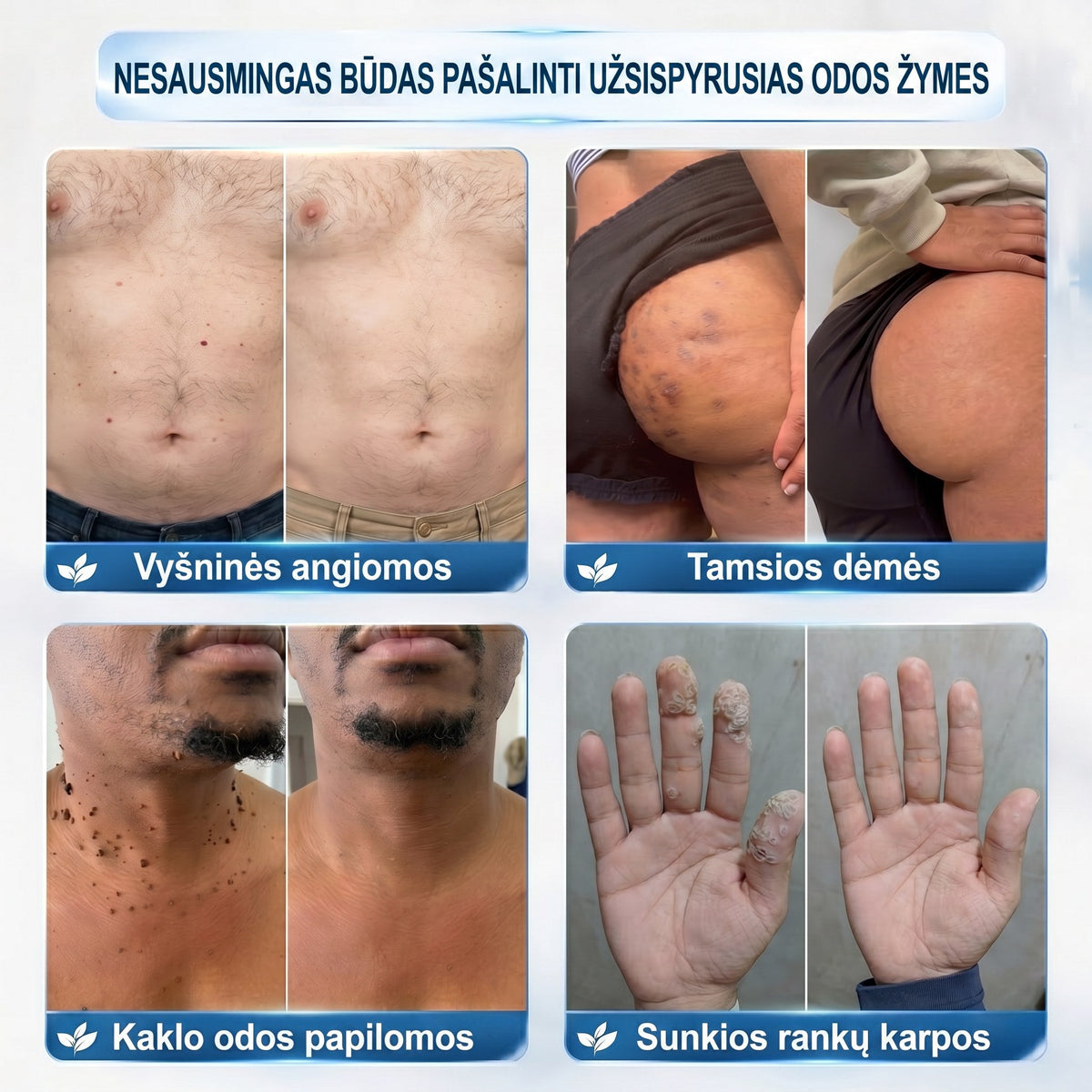 𝐏i𝐜𝐝o® 𝟕 𝐃𝐢𝐞𝐧𝐨𝐬 𝐏𝐢𝐠𝐦𝐞𝐧𝐭𝐢𝐧𝐢ų 𝐃ė𝐦𝐢ų 𝐈𝐫 𝐑𝐚𝐧𝐝ų Š𝐚𝐥𝐢𝐧𝐢𝐦𝐚𝐬 𝐑𝐚š𝐢𝐤𝐥𝐢𝐬✨✨