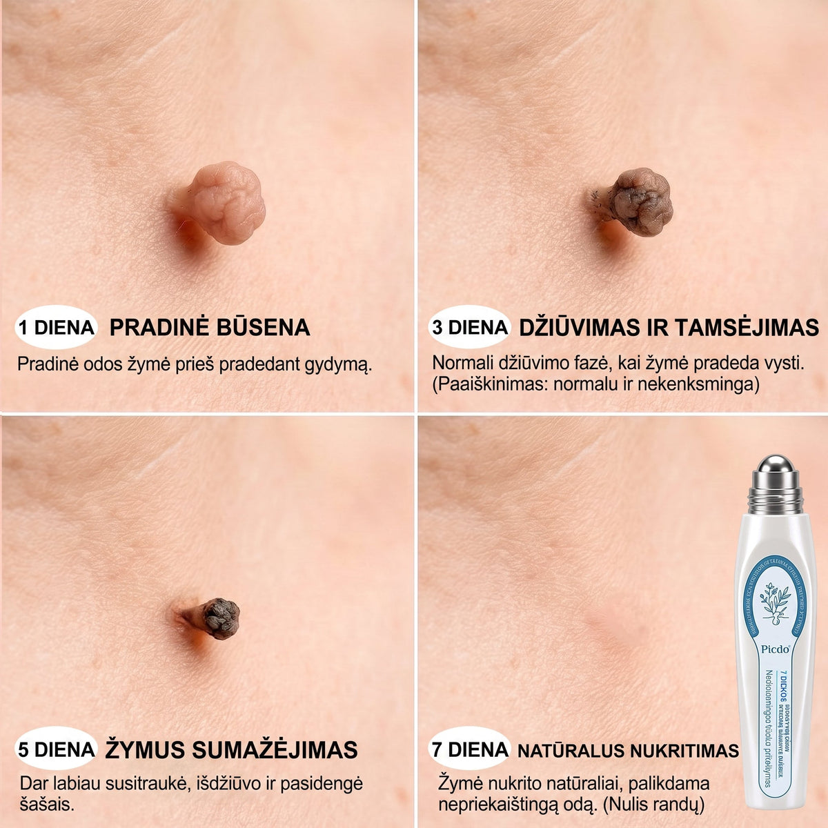 𝐏i𝐜𝐝o® 𝟕 𝐃𝐢𝐞𝐧𝐨𝐬 𝐏𝐢𝐠𝐦𝐞𝐧𝐭𝐢𝐧𝐢ų 𝐃ė𝐦𝐢ų 𝐈𝐫 𝐑𝐚𝐧𝐝ų Š𝐚𝐥𝐢𝐧𝐢𝐦𝐚𝐬 𝐑𝐚š𝐢𝐤𝐥𝐢𝐬✨✨